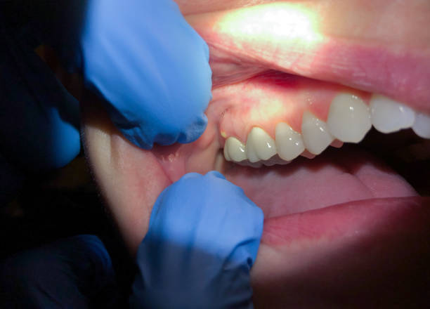 Best Emergency Root Canal Treatment in Bogata, TX